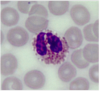 eosinofil granulocytt